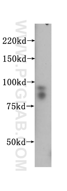 Western Blot (WB) analysis of mouse testis tissue using SSRP1 Polyclonal antibody (15696-1-AP)