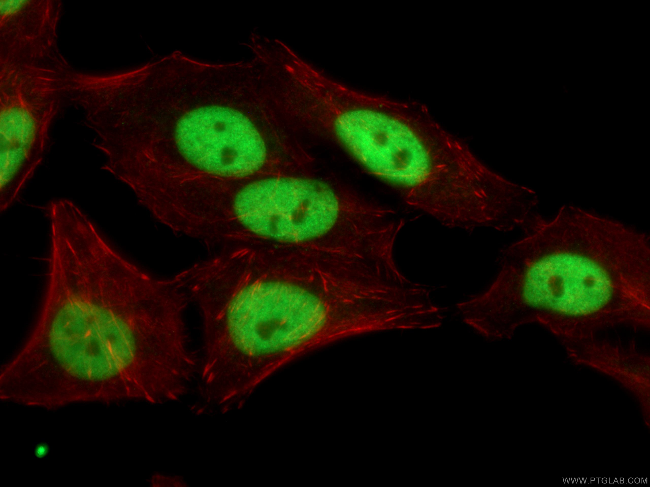 Immunofluorescence (IF) / fluorescent staining of HepG2 cells using SSRP1 Monoclonal antibody (67313-1-Ig)