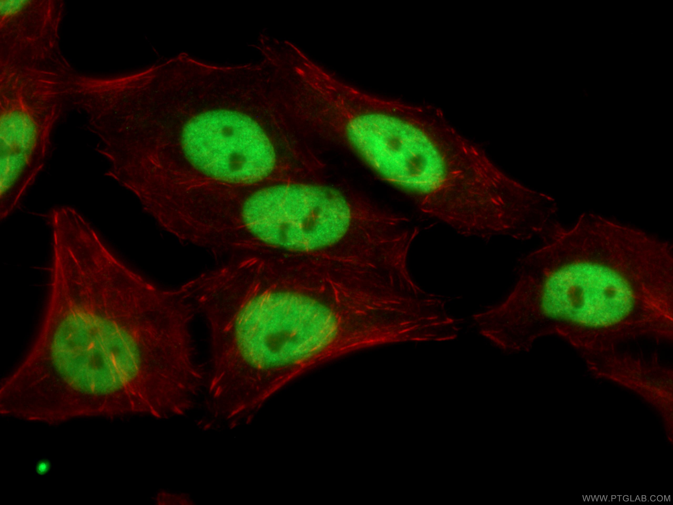 IF Staining of HepG2 using 67313-1-Ig