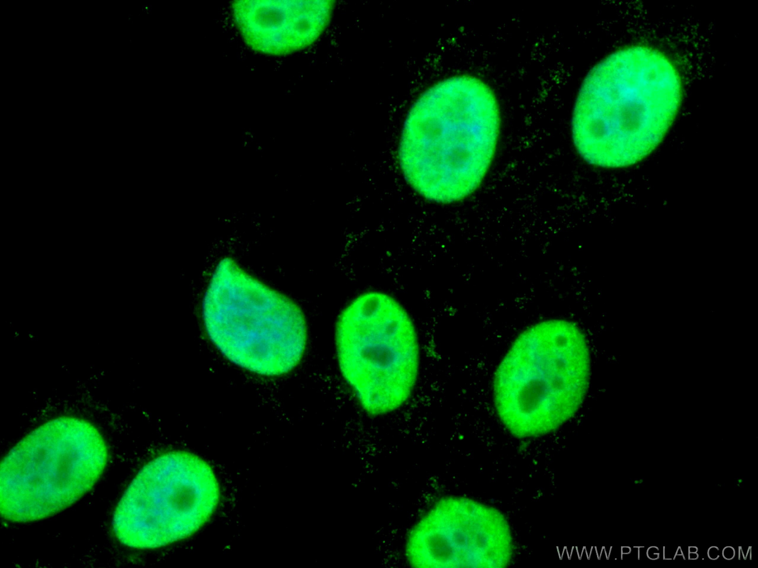 Immunofluorescence (IF) / fluorescent staining of HepG2 cells using SSRP1 Monoclonal antibody (67313-1-Ig)