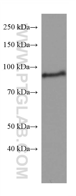 Western Blot (WB) analysis of 4T1 cells using SSRP1 Monoclonal antibody (67313-1-Ig)