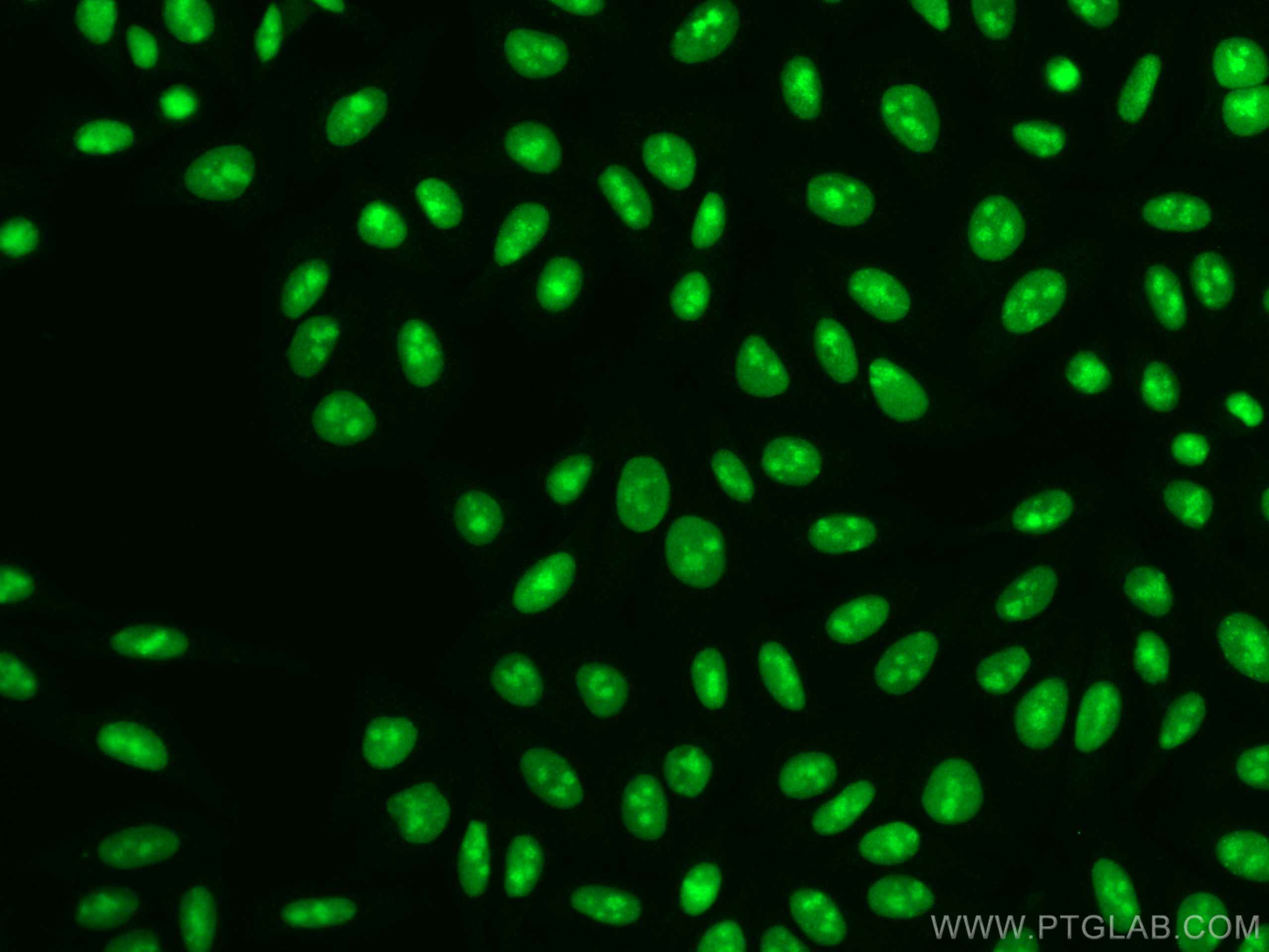 Immunofluorescence (IF) / fluorescent staining of HepG2 cells using CoraLite® Plus 488-conjugated SSRP1 Monoclonal ant (CL488-67313)