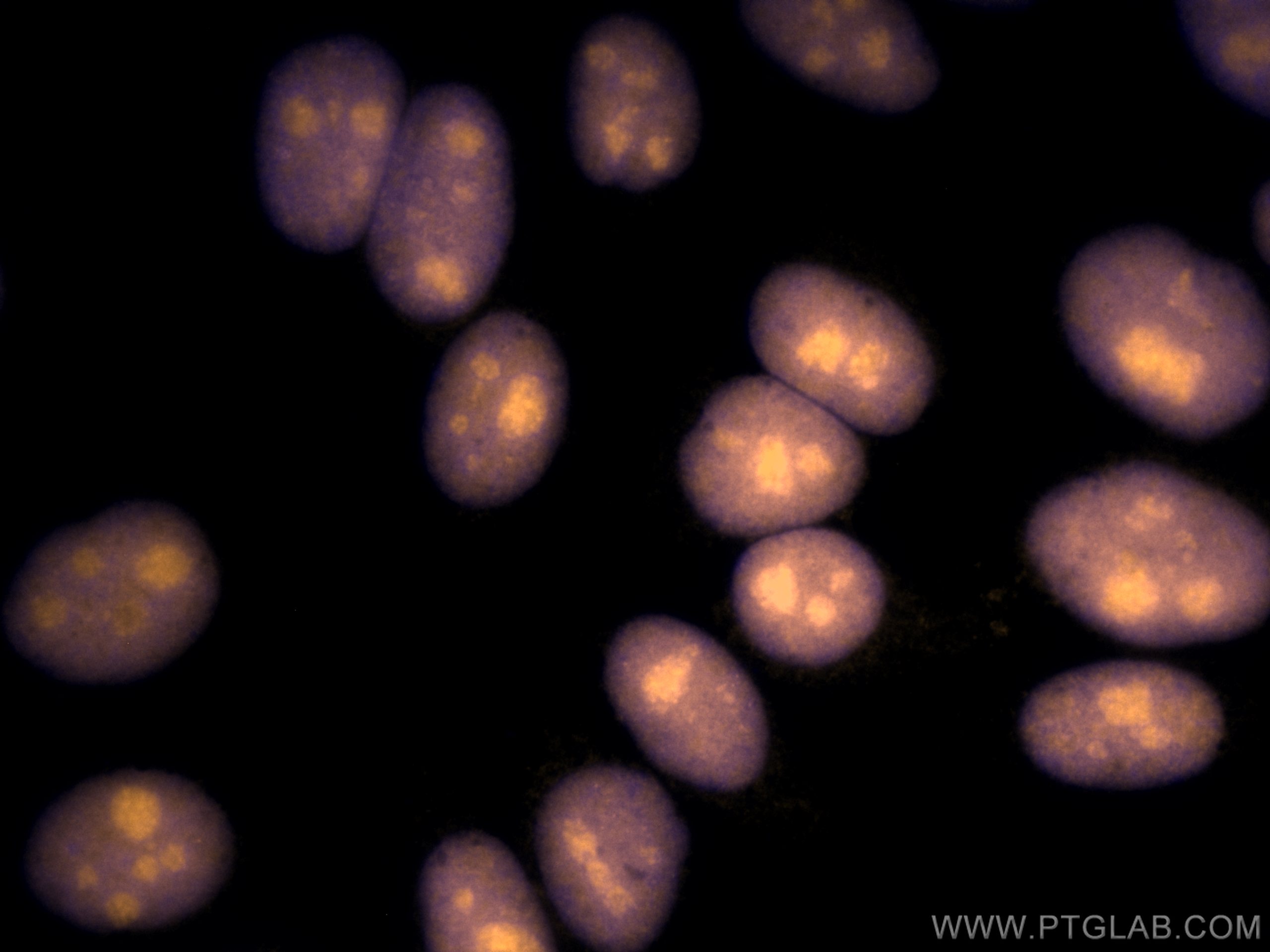 Immunofluorescence (IF) / fluorescent staining of HepG2 cells using CoraLite®555-conjugated SSRP1 Monoclonal antibody (CL555-67313)