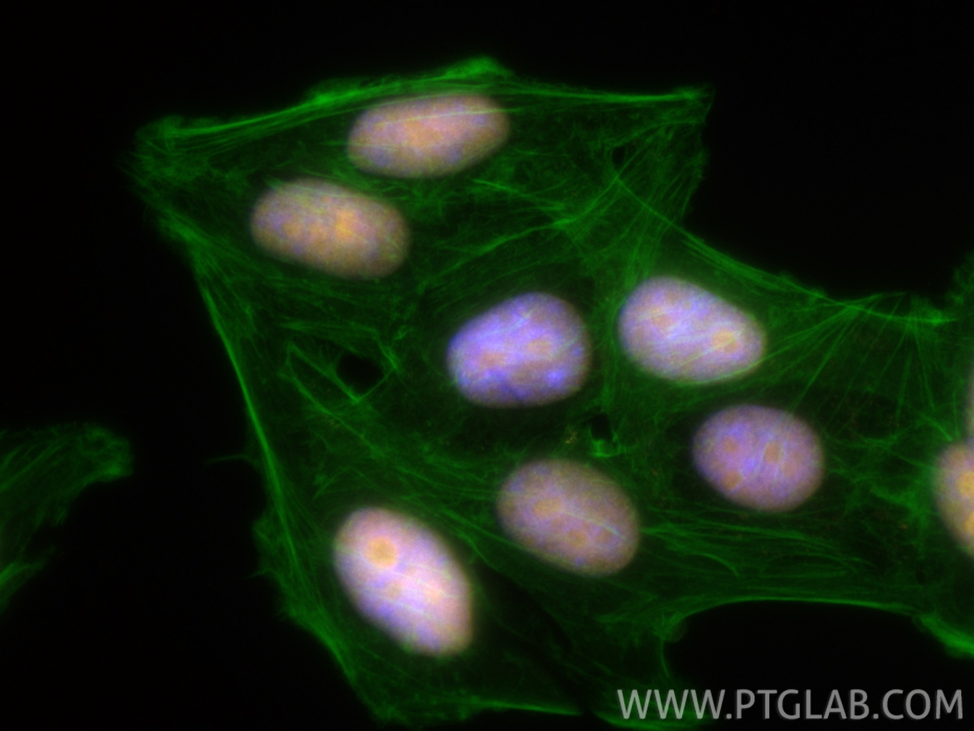 IF Staining of HepG2 using CL555-67313 Immunofluorescence (IF) / fluorescent staining of HepG2 cells using CoraLite®555-conjugated SSRP1 Monoclonal antibody (CL555-67313)