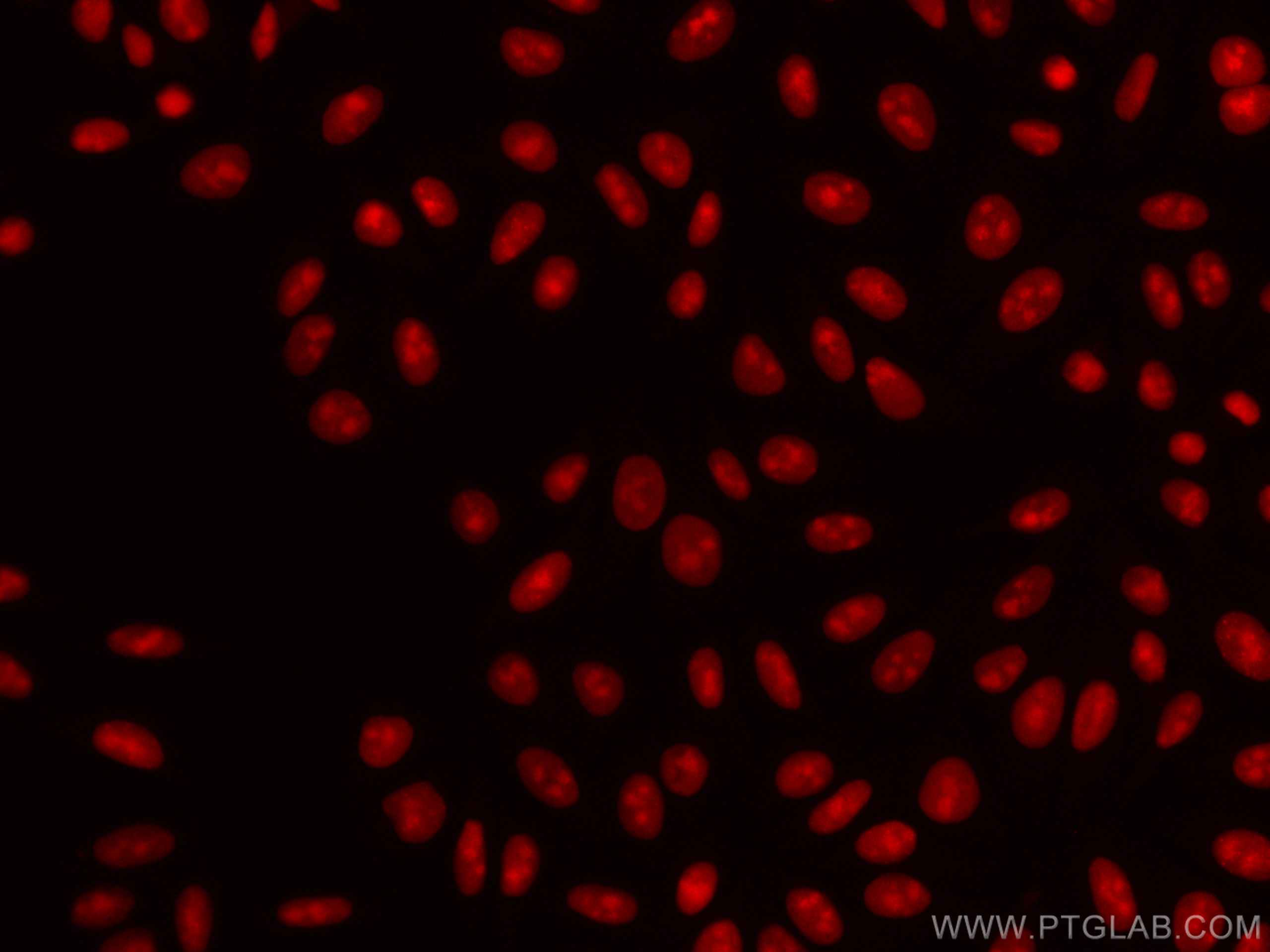 IF Staining of HepG2 using CL594-67313