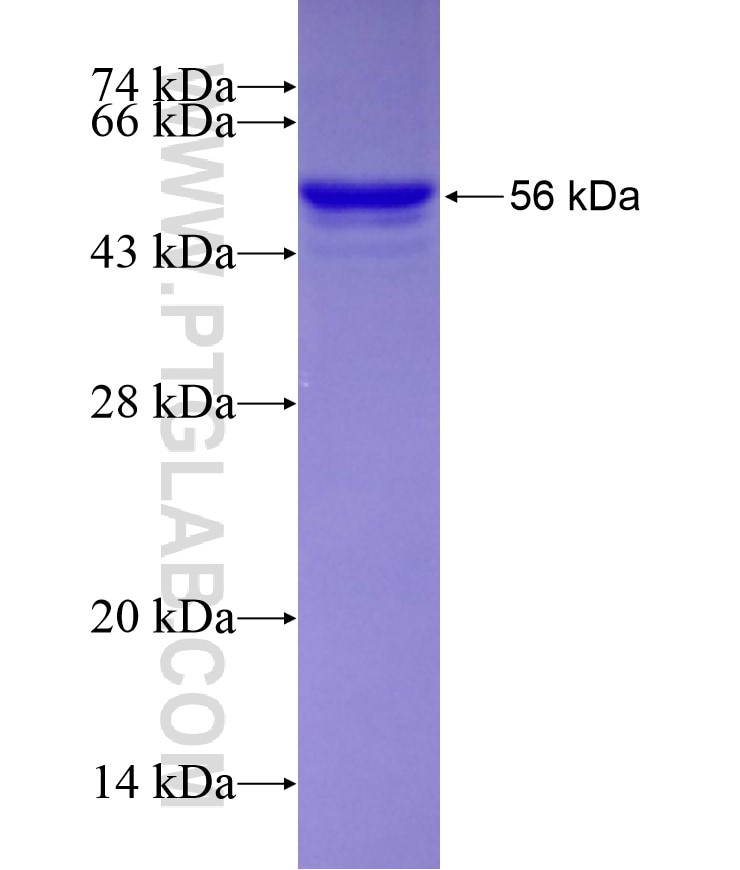 SSRP1 fusion protein Ag8318 SDS-PAGE