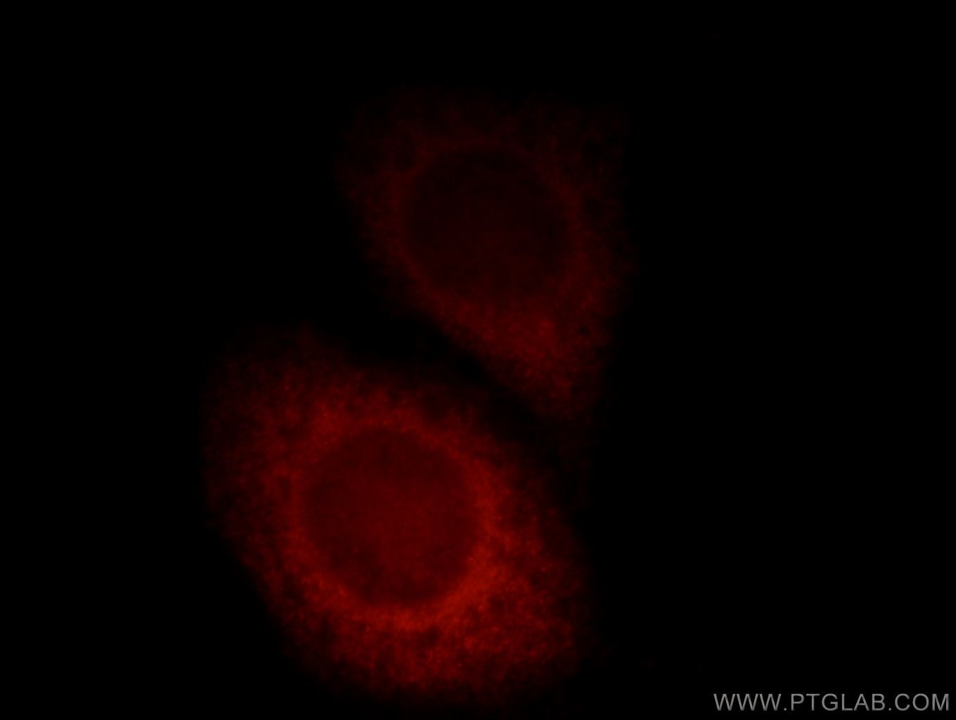 Immunofluorescence (IF) / fluorescent staining of HeLa cells using SSSCA1 Polyclonal antibody (12273-1-AP)