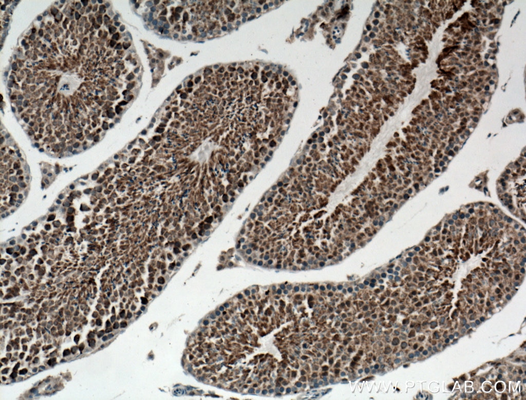 Immunohistochemistry (IHC) staining of mouse testis tissue using SSSCA1 Polyclonal antibody (12273-1-AP)