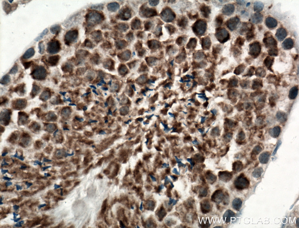 Immunohistochemistry (IHC) staining of mouse testis tissue using SSSCA1 Polyclonal antibody (12273-1-AP)