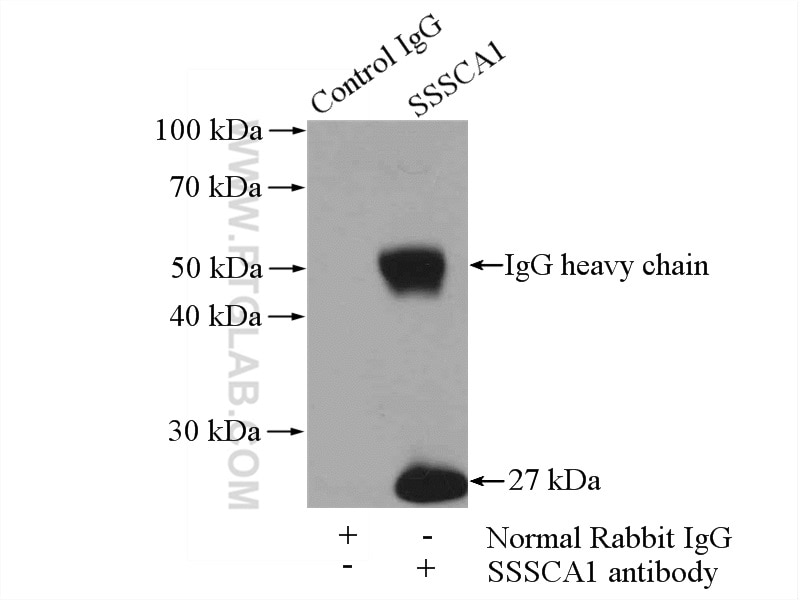 Immunoprecipitation (IP) experiment of HeLa cells using SSSCA1 Polyclonal antibody (12273-1-AP)