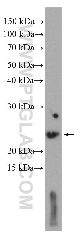 Western Blot (WB) analysis of NIH/3T3 cells using SSSCA1 Polyclonal antibody (12273-1-AP)