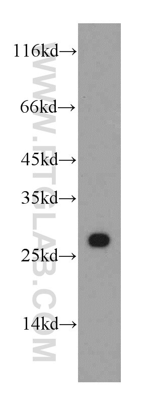 Western Blot (WB) analysis of A549 cells using SSSCA1 Polyclonal antibody (12273-1-AP)