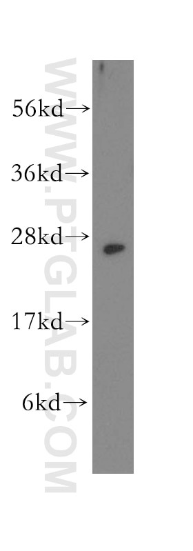 Western Blot (WB) analysis of HeLa cells using SSSCA1 Polyclonal antibody (12273-1-AP)