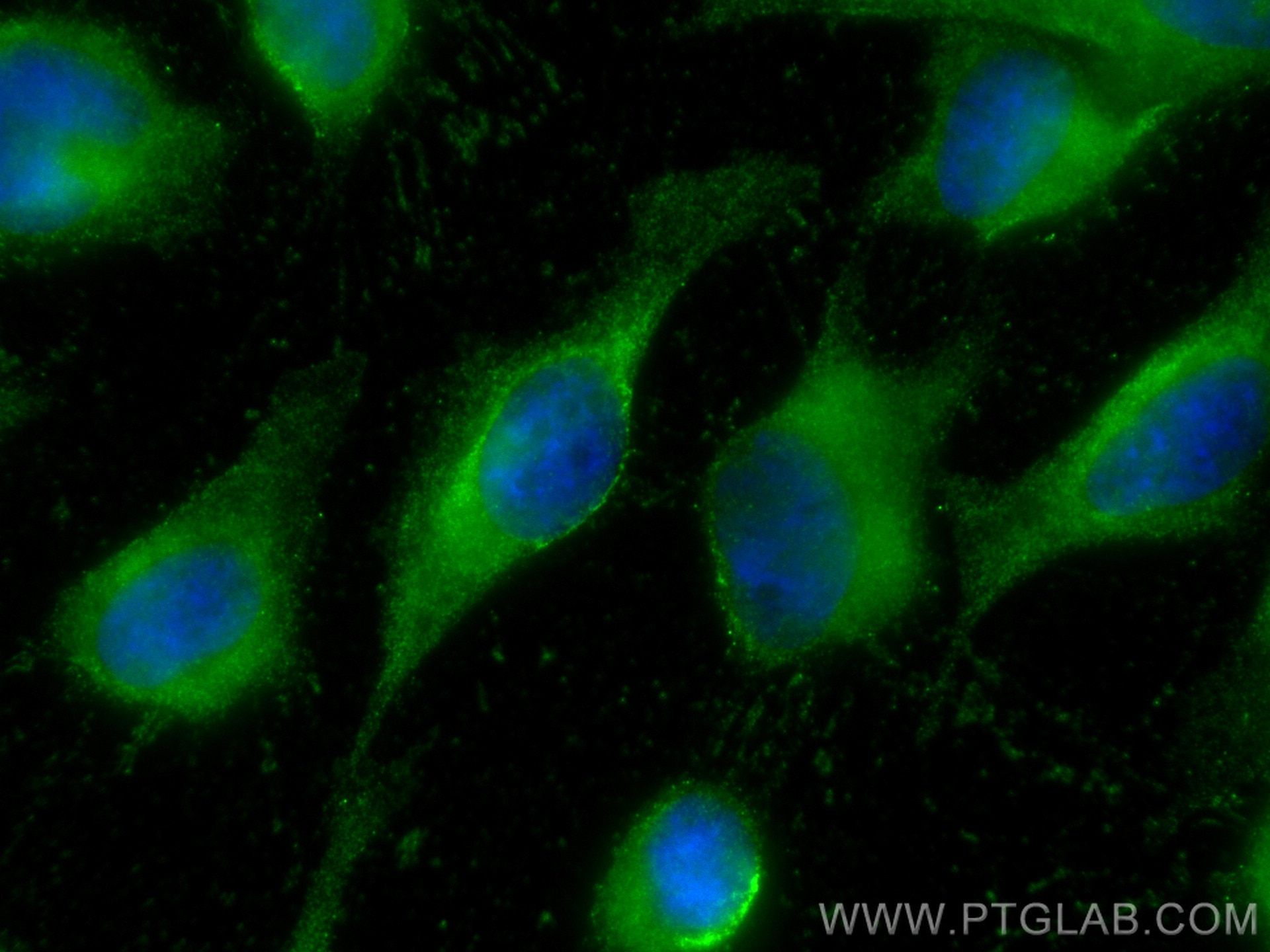 Immunofluorescence (IF) / fluorescent staining of HeLa cells using SSSCA1 Monoclonal antibody (68423-1-Ig)