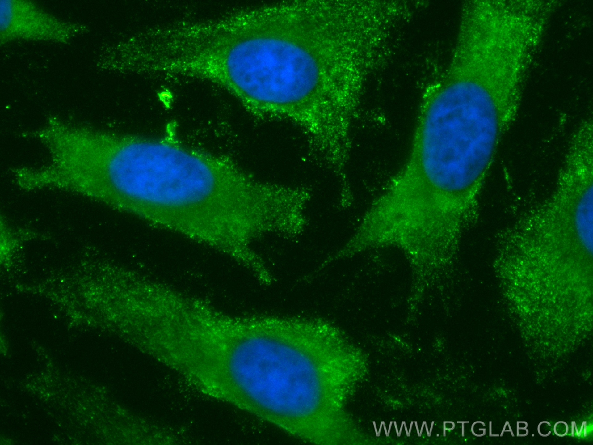 IF Staining of HeLa using CL488-68423