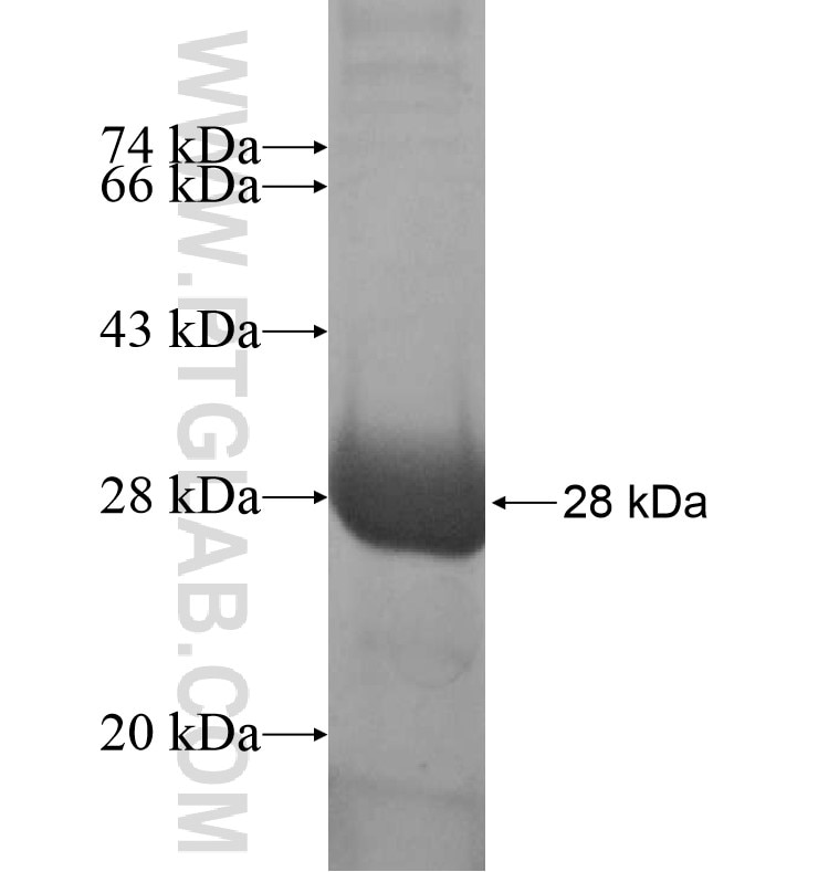 SSSCA1 fusion protein Ag16783 SDS-PAGE