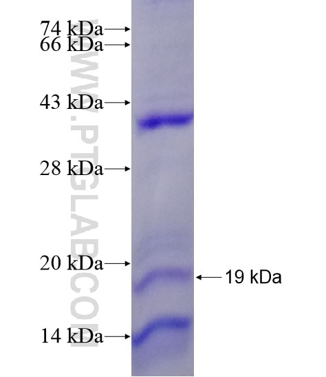 SST fusion protein Ag21294 SDS-PAGE