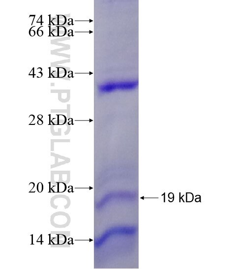 SST fusion protein Ag21294 SDS-PAGE