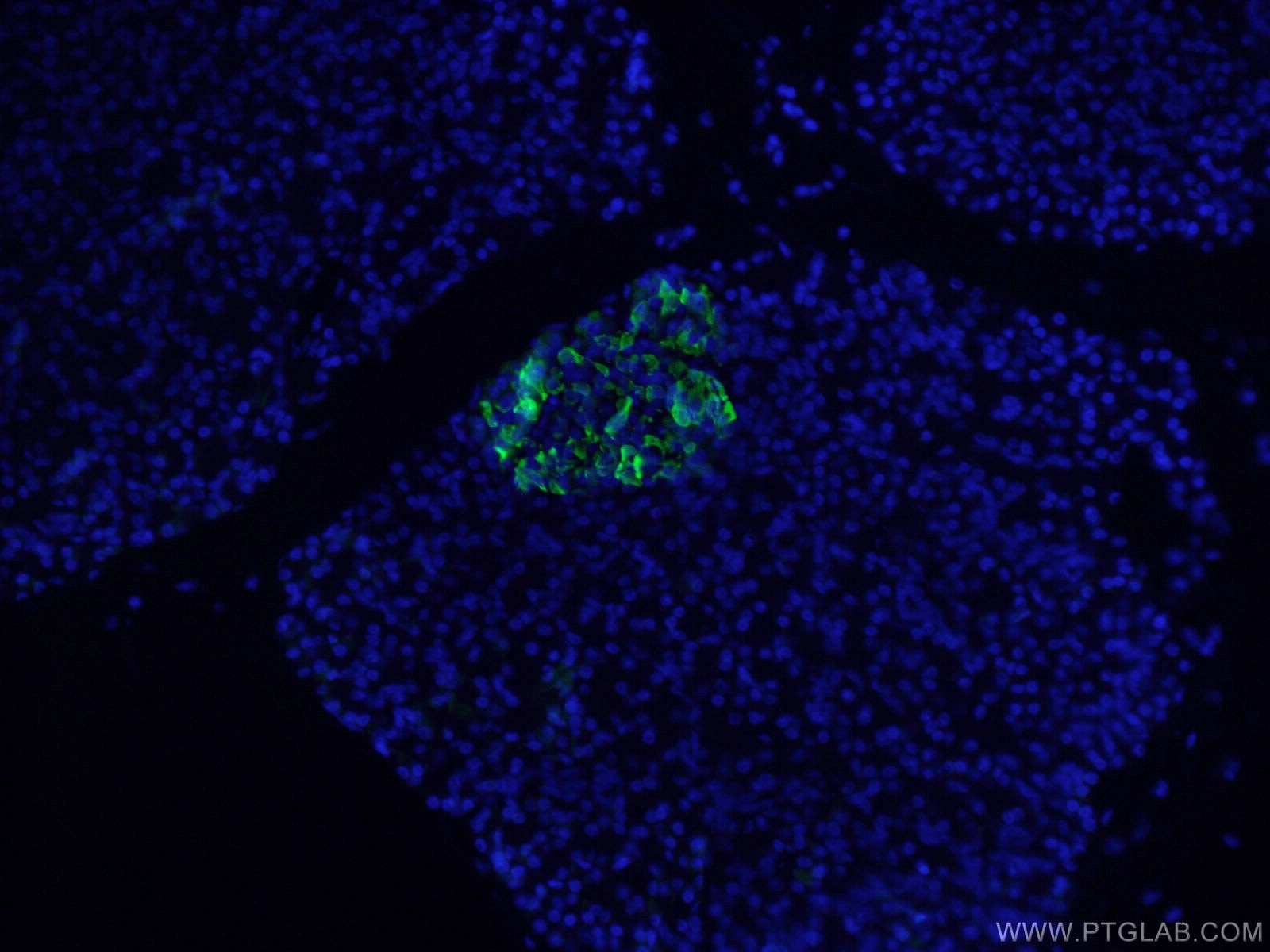 Immunofluorescence (IF) / fluorescent staining of human pancreas tissue using Somatostatin (64-81aa) Polyclonal antibody (17512-1-AP)