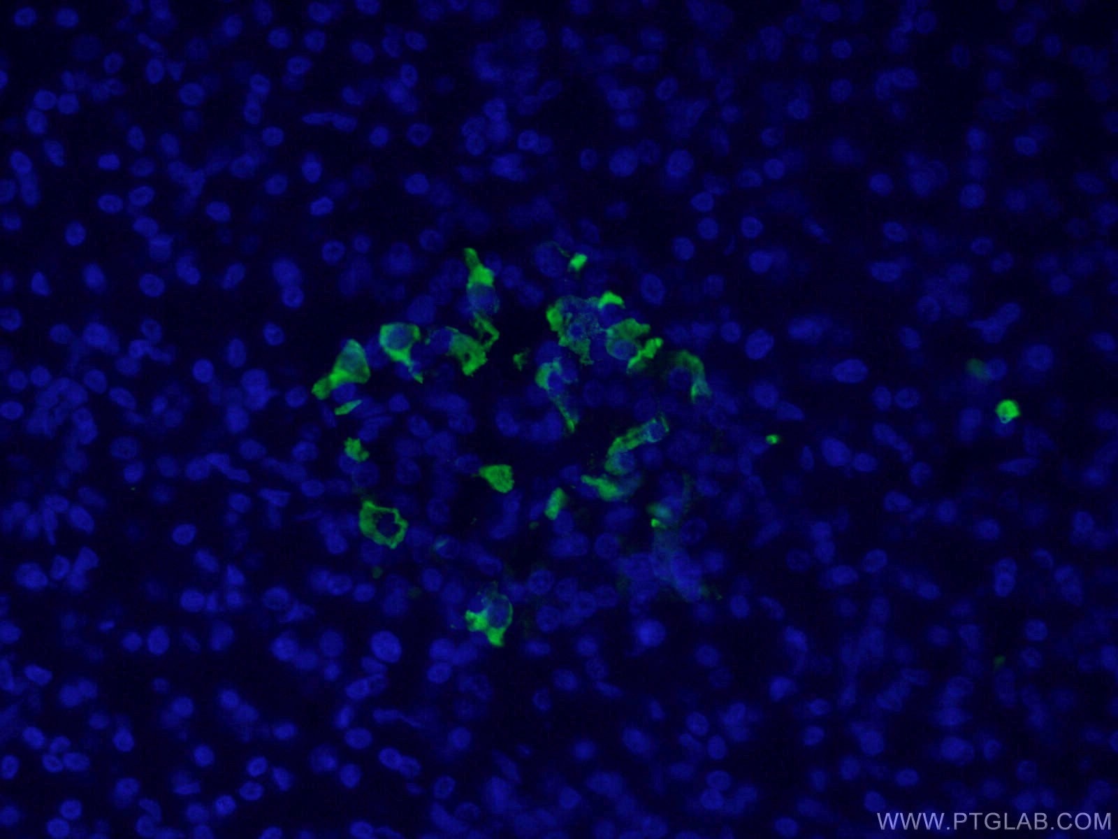 Immunofluorescence (IF) / fluorescent staining of human pancreas tissue using Somatostatin (64-81aa) Polyclonal antibody (17512-1-AP)