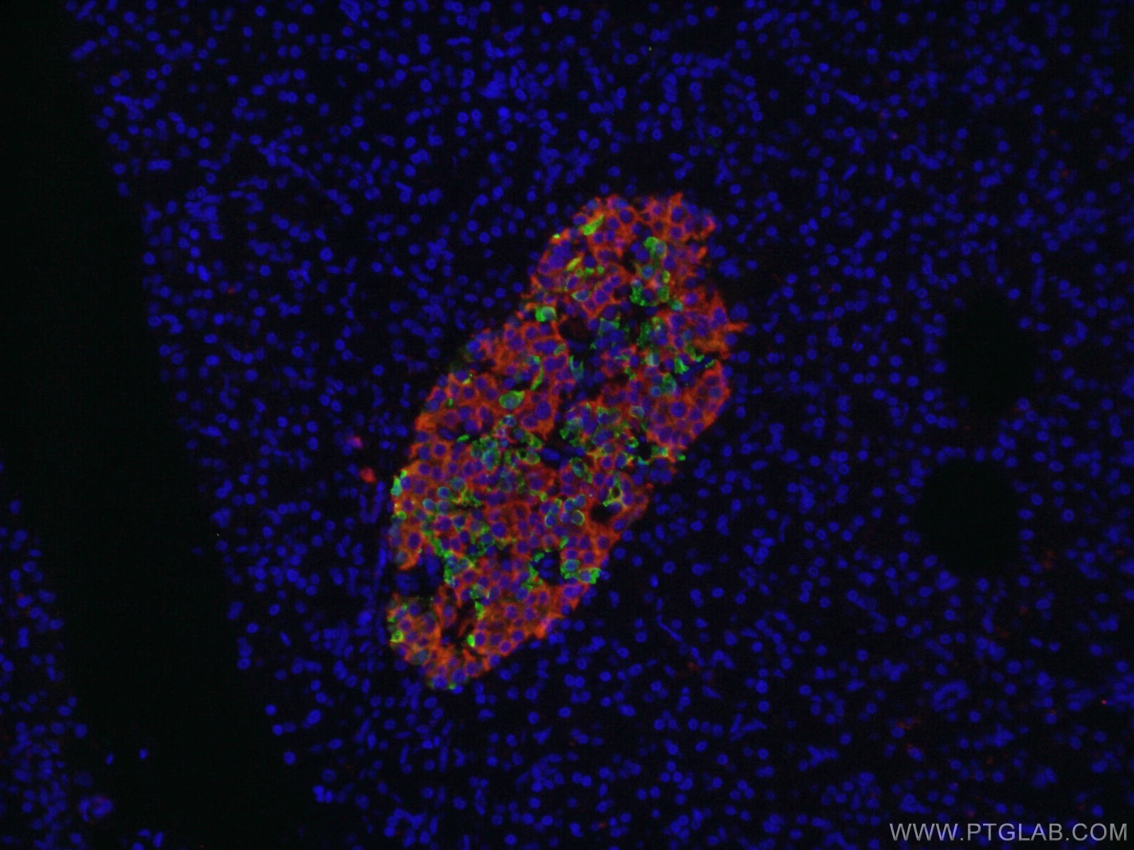 Immunofluorescence (IF) / fluorescent staining of human pancreas tissue using Somatostatin (64-81aa) Polyclonal antibody (17512-1-AP)