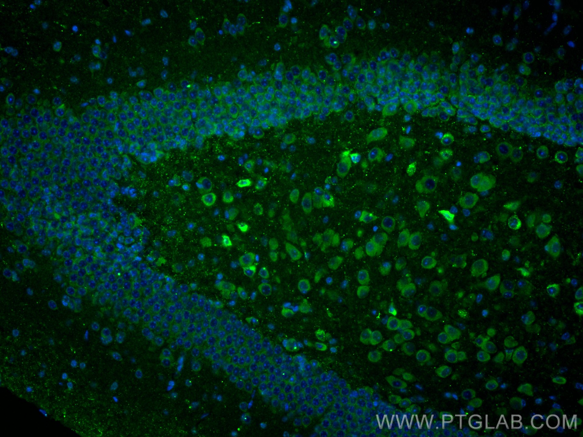 IF Staining of mouse brain using 17512-1-AP