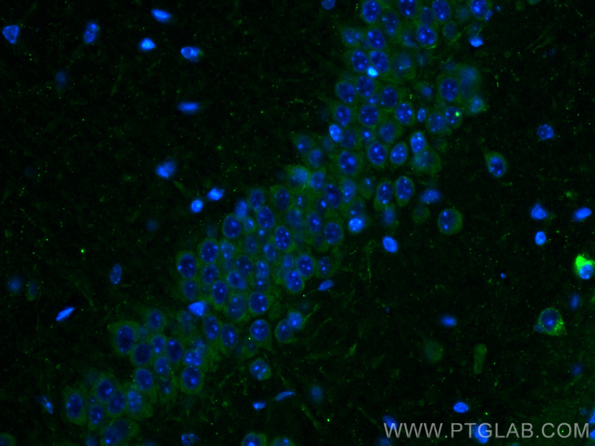 Immunofluorescence (IF) / fluorescent staining of mouse brain tissue using Somatostatin (64-81aa) Polyclonal antibody (17512-1-AP)