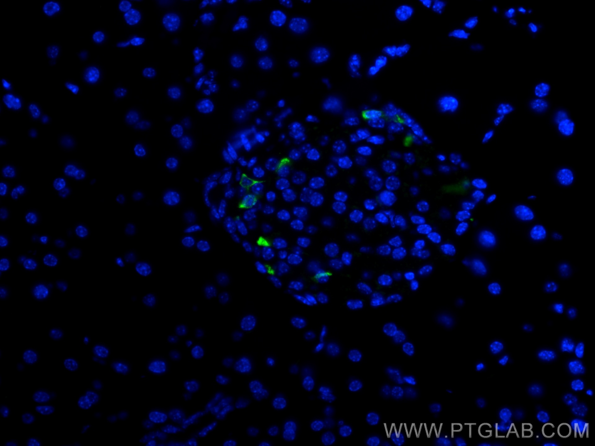 Immunofluorescence (IF) / fluorescent staining of mouse pancreas tissue using Somatostatin (64-81aa) Polyclonal antibody (17512-1-AP)