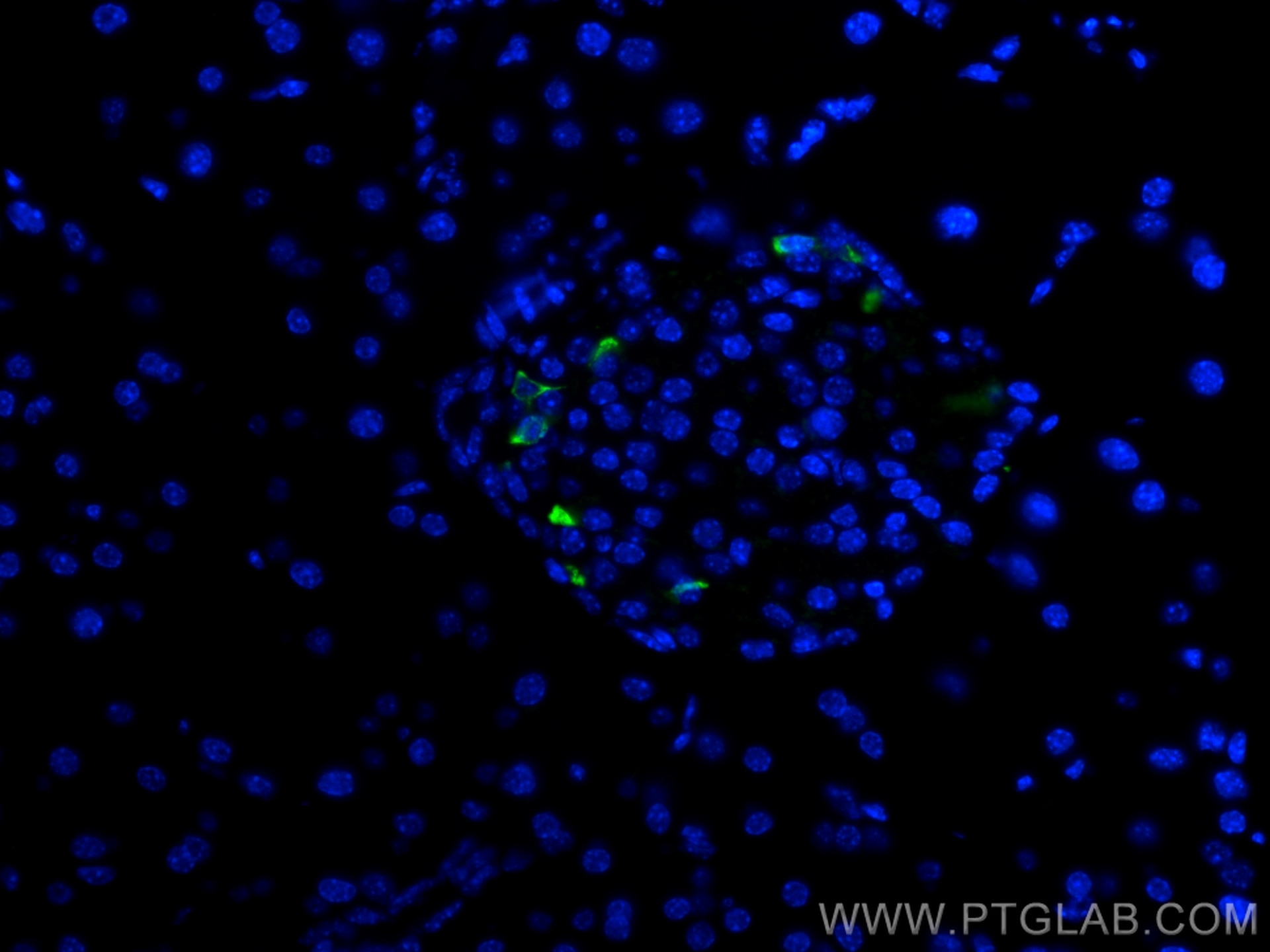 IF Staining of mouse pancreas using 17512-1-AP