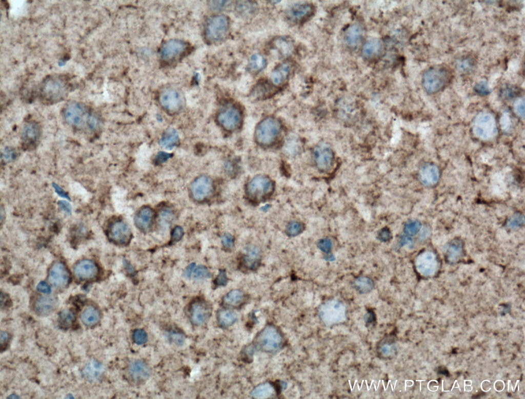 Immunohistochemistry (IHC) staining of mouse brain tissue using Somatostatin (64-81aa) Polyclonal antibody (17512-1-AP)