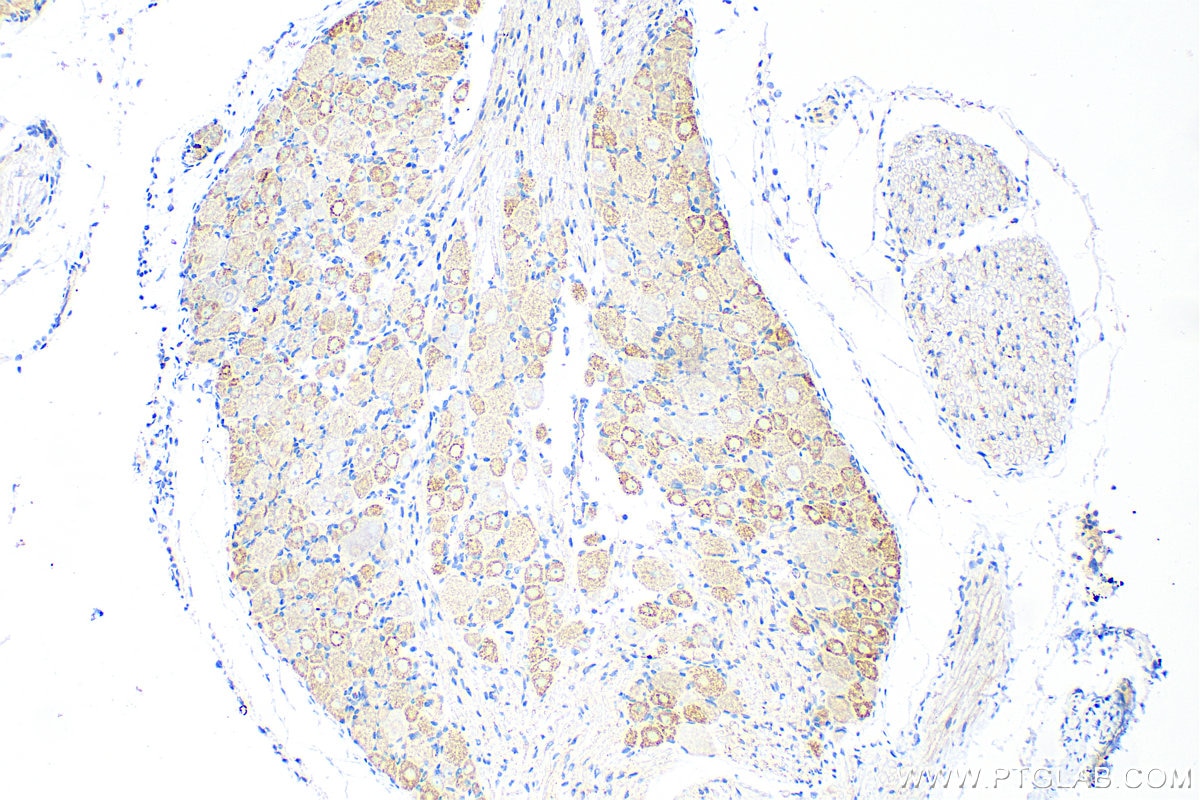 Immunohistochemistry (IHC) staining of rat dorsal root ganglion tissue using Somatostatin (64-81aa) Polyclonal antibody (17512-1-AP)