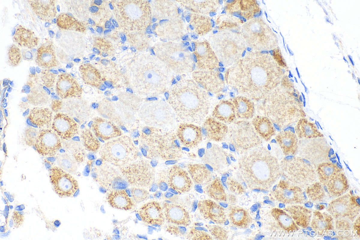 Immunohistochemistry (IHC) staining of rat dorsal root ganglion tissue using Somatostatin (64-81aa) Polyclonal antibody (17512-1-AP)