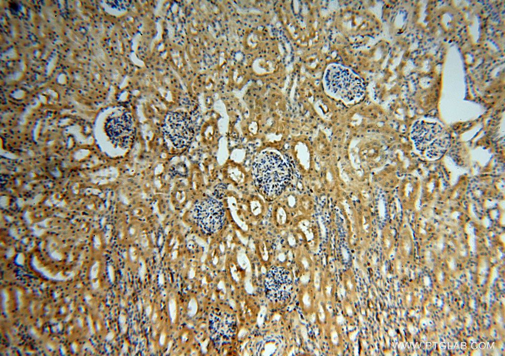 Somatostatin (64-81aa)