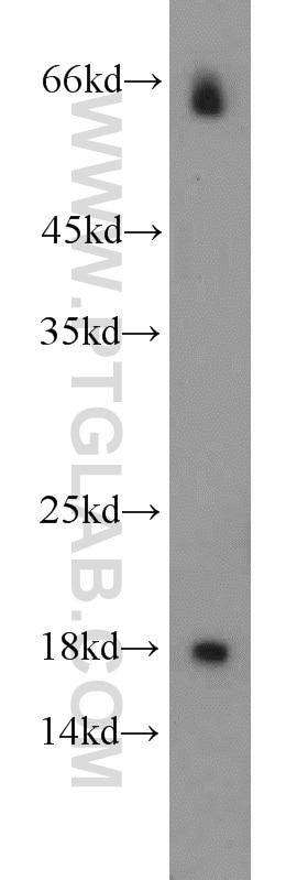 Somatostatin (64-81aa) Polyclonal antibody