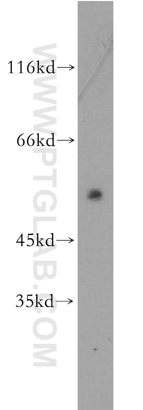 Western Blot (WB) analysis of SH-SY5Y cells using SSTR1 Polyclonal antibody (20587-1-AP)