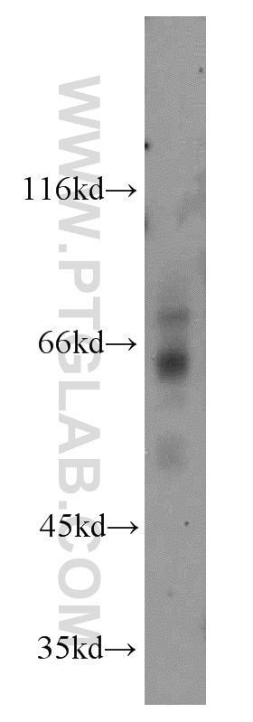 Western Blot (WB) analysis of mouse brain tissue using SSTR1 Polyclonal antibody (20587-1-AP)