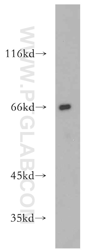 Western Blot (WB) analysis of BxPC-3 cells using SSTR1 Polyclonal antibody (20587-1-AP)