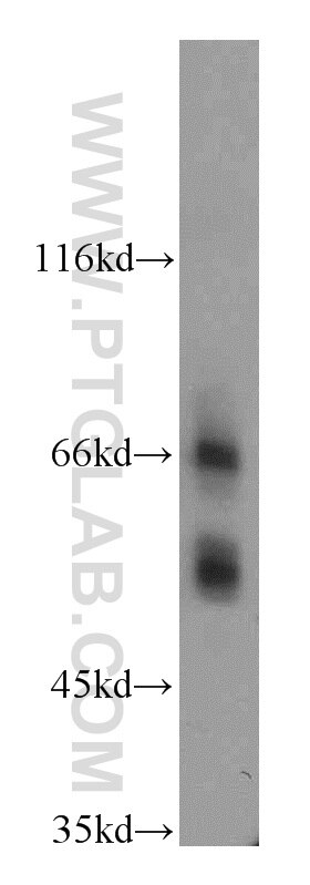 Western Blot (WB) analysis of mouse small intestine tissue using SSTR1 Polyclonal antibody (20587-1-AP)
