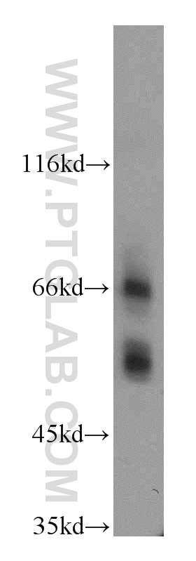 WB analysis of mouse small intestine using 20587-1-AP