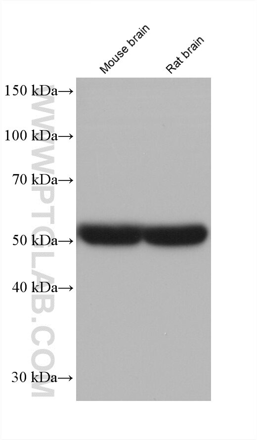 Western Blot (WB) analysis of various lysates using SSTR1 Monoclonal antibody (60681-2-Ig)