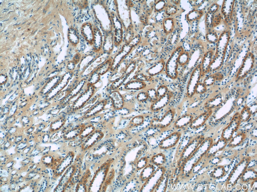 Immunohistochemistry (IHC) staining of human kidney tissue using SSTR2 Polyclonal antibody (20404-1-AP)