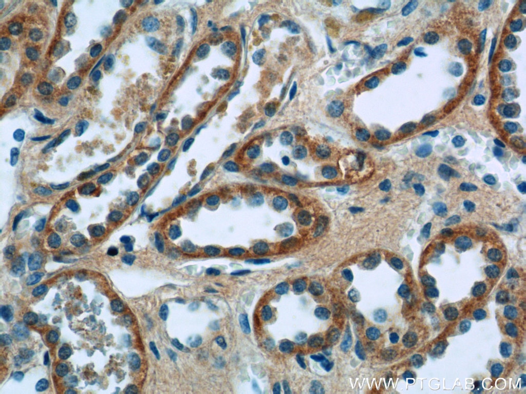 Immunohistochemistry (IHC) staining of human kidney tissue using SSTR2 Polyclonal antibody (20404-1-AP)