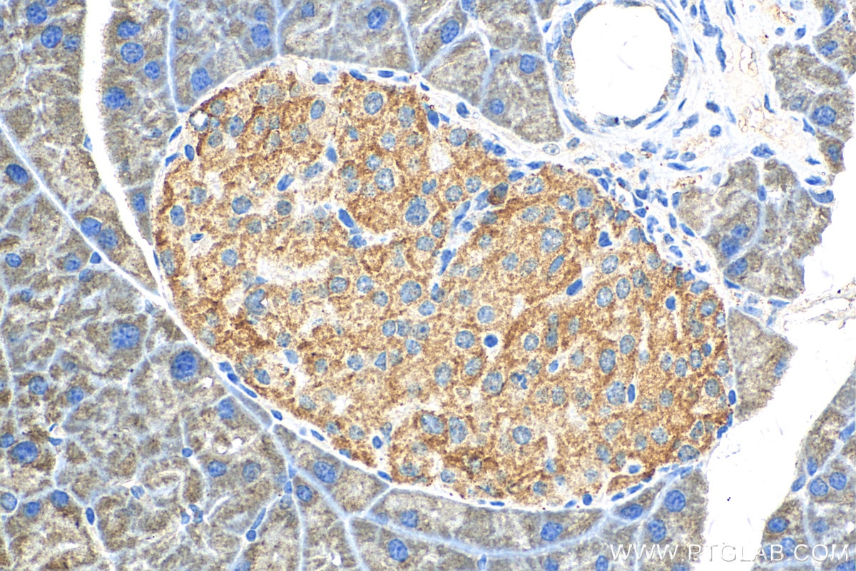 Immunohistochemistry (IHC) staining of mouse pancreas tissue using SSTR2 Polyclonal antibody (20404-1-AP)