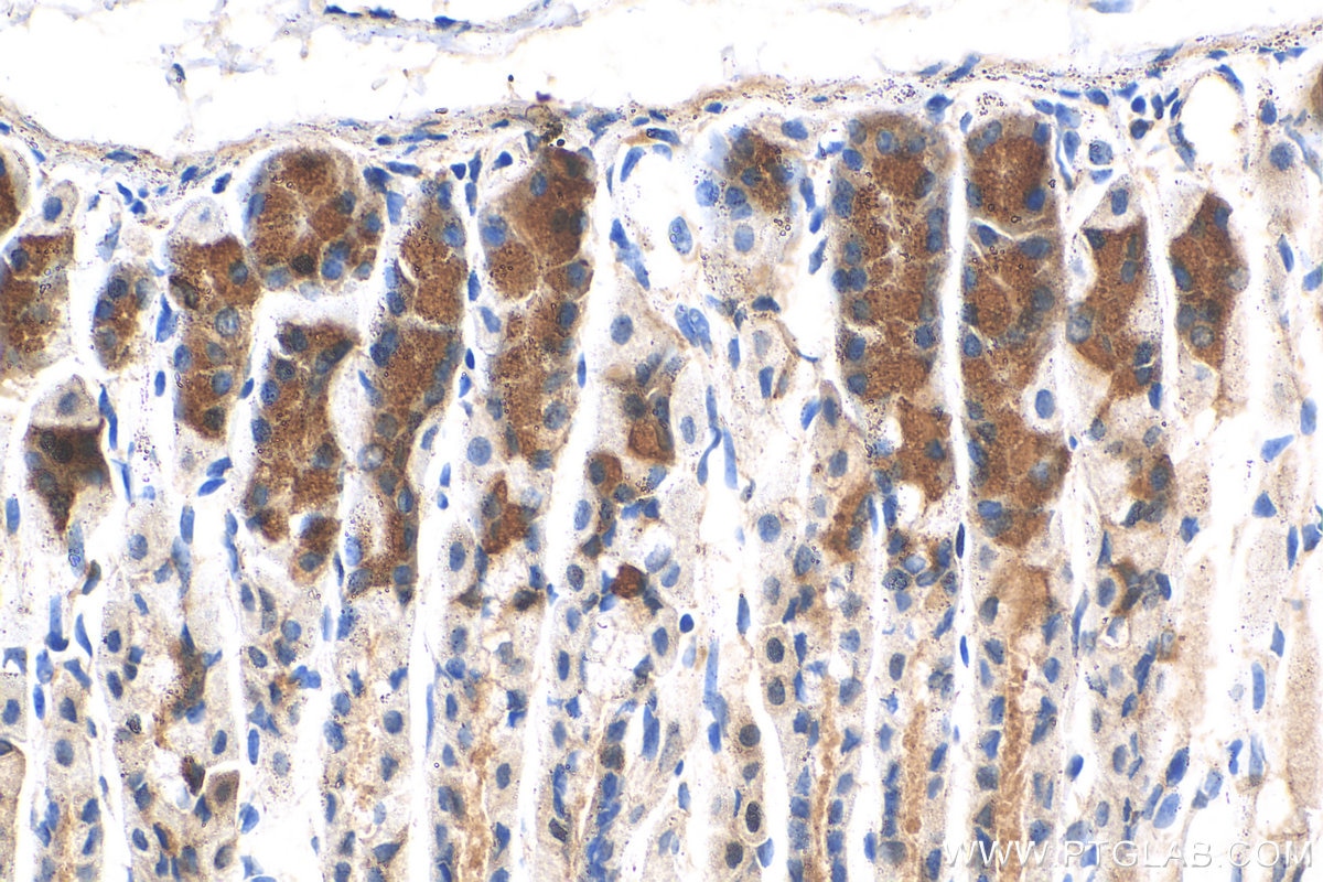 Immunohistochemistry (IHC) staining of mouse stomach tissue using SSTR2 Polyclonal antibody (20404-1-AP)