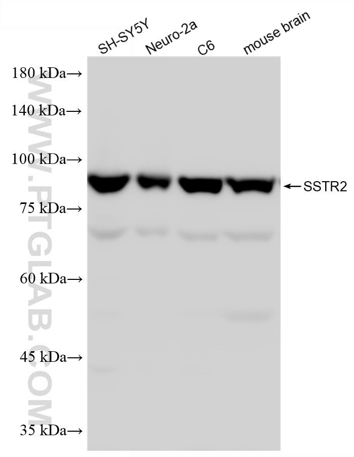 Western Blot (WB) analysis of various lysates using SSTR2 Recombinant monoclonal antibody (87663-1-RR)