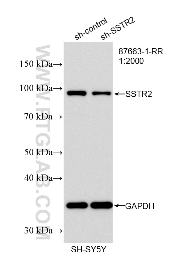 Western Blot (WB) analysis of SH-SY5Y cells using SSTR2 Recombinant monoclonal antibody (87663-1-RR)