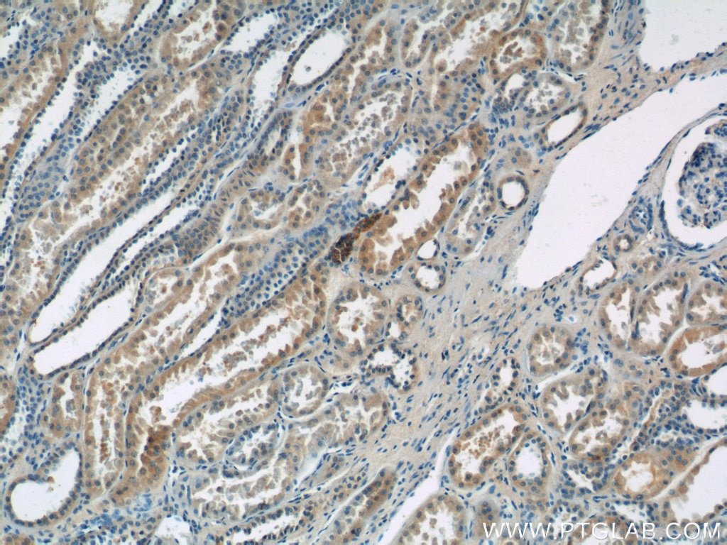 Immunohistochemistry (IHC) staining of human kidney tissue using SSTR3 Polyclonal antibody (20696-1-AP)