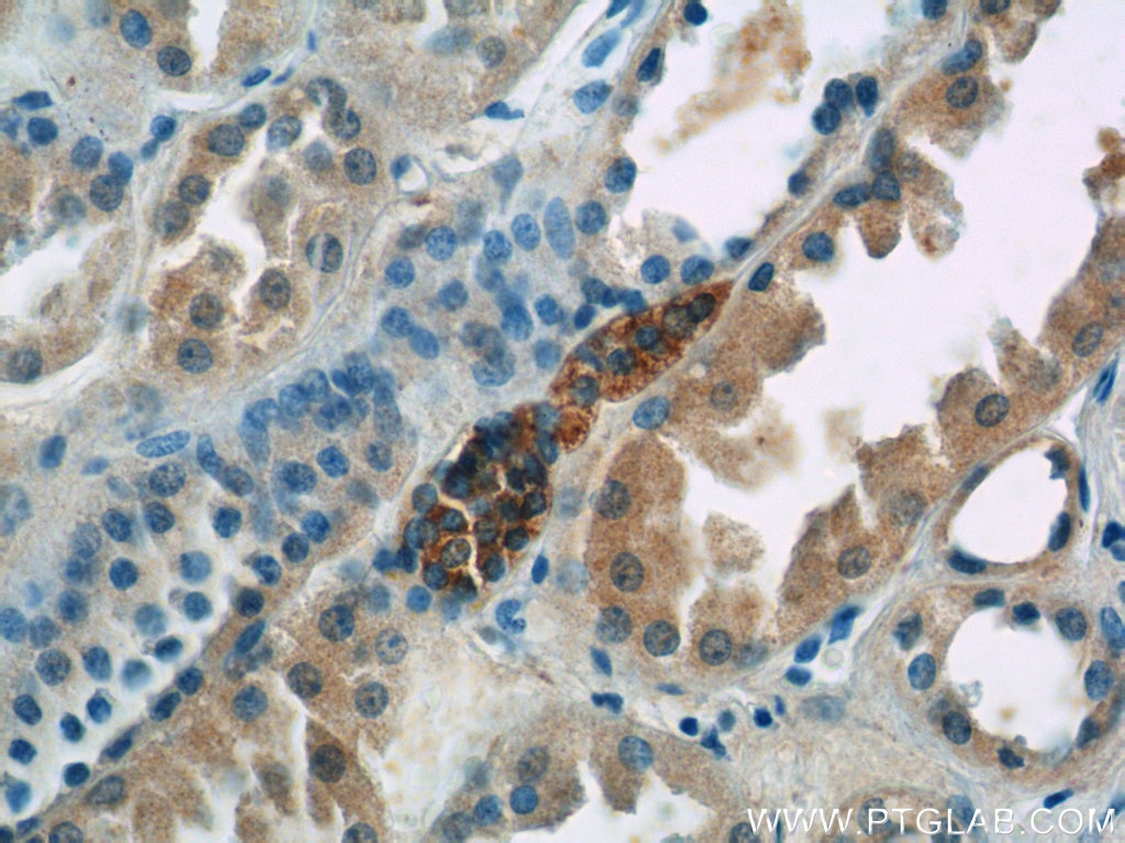 Immunohistochemistry (IHC) staining of human kidney tissue using SSTR3 Polyclonal antibody (20696-1-AP)