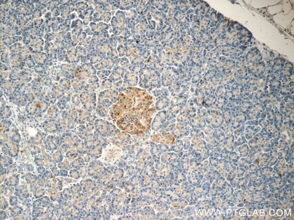 Immunohistochemistry (IHC) staining of human pancreas tissue using SSTR3 Polyclonal antibody (20696-1-AP)