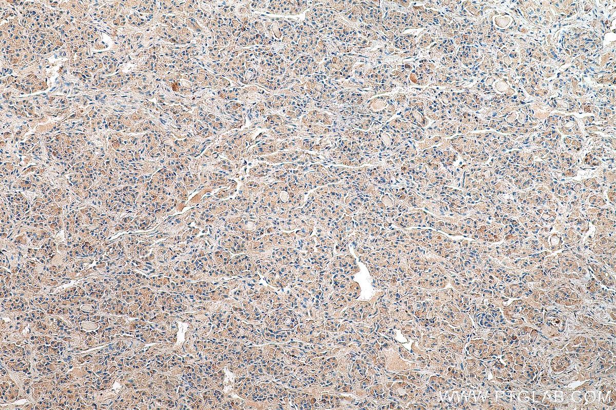 IHC staining of human pituitary using 20696-1-AP Immunohistochemistry (IHC) staining of human pituitary tissue using SSTR3 Polyclonal antibody (20696-1-AP)
